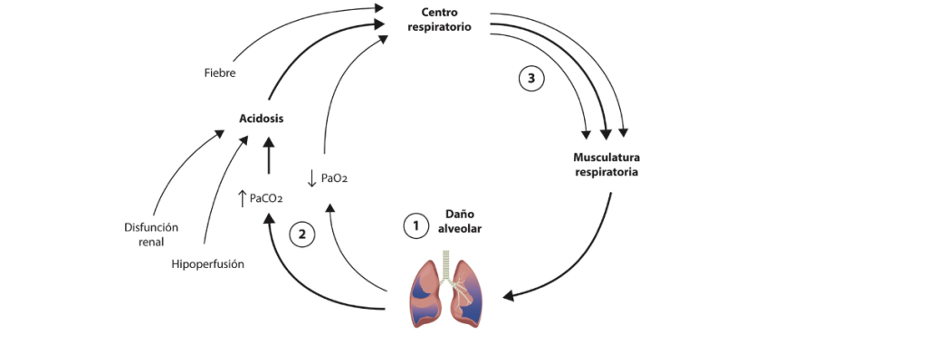 Figura. Ilustración que muestra el círculo vicioso que genera el daño inducido por la propia ventilación (P-SILI).